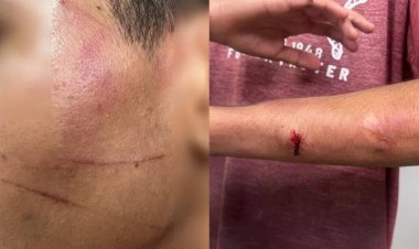 Pai é preso por torturar filhos com facão: "Preciso educá-los"