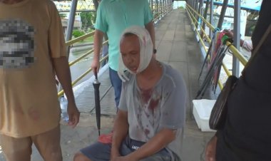 Quatro pessoas ficam feridas após calçada ceder e buraco abrir em ponto de ônibus: 'Minha cabeça está cheia de vidro', diz vítima