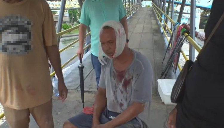 Quatro pessoas ficam feridas após calçada ceder e buraco abrir em ponto de ônibus: 'Minha cabeça está cheia de vidro', diz vítima