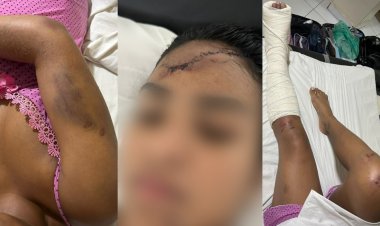 'Não aguentava mais apanhar': mulher que caiu de prédio conta que se jogou para não morrer